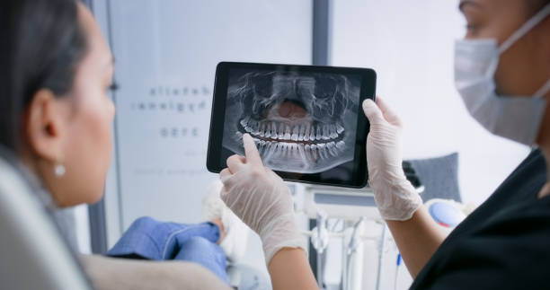 Licensed Tooth Extraction service in Jersey City, NJ - Smile Center Dentistry